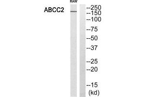 Western Blotting (WB) image for anti-ATP-Binding Cassette, Sub-Family C (CFTR/MRP), Member 2 (ABCC2) (Internal Region) antibody (ABIN1850979) (ABCC2 antibody  (Internal Region))