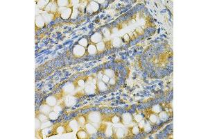 Immunohistochemistry of paraffin-embedded rat intestine using PGK1 Antibody. (PGK1 antibody  (AA 1-417))