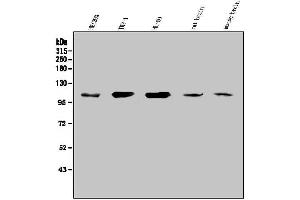Western blot analysis of SEZ6L using anti-SEZ6L antibody (ABIN7602260).