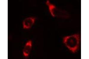 Immunofluorescence (fixed cells) (IF/ICC) image for anti-Synuclein, beta (SNCB) (C-Term) antibody (ABIN6265408)