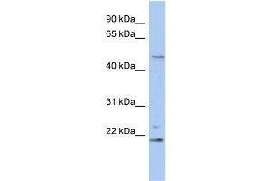 WB Suggested Anti-RBBP9 Antibody Titration:  0. (RBBP9 antibody  (N-Term))