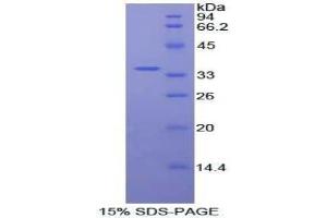 SDS-PAGE analysis of Human Protein Kinase B beta Protein. (AKT2 Protein)