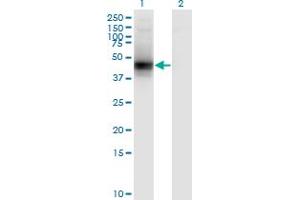 Western Blot analysis of DCN expression in transfected 293T cell line by DCN monoclonal antibody (M01), clone 3H4-1F4. (Decorin antibody  (AA 1-359))