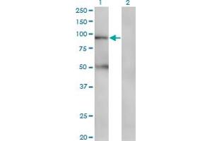 Western Blotting (WB) image for anti-Transporter 1, ATP-Binding Cassette, Sub-Family B (MDR/TAP) (TAP1) (AA 241-350) antibody (ABIN961455) (TAP1 antibody  (AA 241-350))