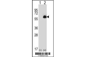 Western blot analysis of ALDH4A1 using rabbit polyclonal ALDH4A1 Antibody using 293 cell lysates (2 ug/lane) either nontransfected (Lane 1) or transiently transfected (Lane 2) with the ALDH4A1 gene. (ALDH4A1 antibody  (C-Term))