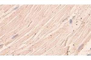 Immunohistochemical staining of formalin-fixed paraffin-embedded human skeletal muscle showing staining with ANGPTL1 polyclonal antibody  at 1:100 dilution. (ANGPTL1 antibody)
