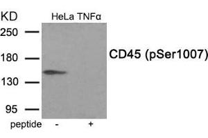 Western Blotting (WB) image for anti-Protein tyrosine Phosphatase, Receptor Type, C (PTPRC) (pSer1007) antibody (ABIN7138403)
