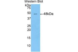 Detection of Recombinant DPT, Mouse using Polyclonal Antibody to Dermatopontin (DPT) (Dermatopontin antibody  (AA 29-197))