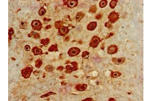 Immunohistochemistry of paraffin-embedded human placenta tissue using ABIN7156860 at dilution of 1:100 (IL22RA2 antibody  (AA 22-263))
