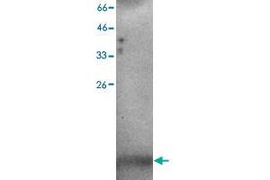 Western blot analysis of H520 whole cell lystae with C3orf10 monoclonal antibody, clone 37  at 1:500 dilution. (BRK1 antibody)