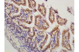Formalin-fixed and paraffin embedded mouse intestine labeled with Rabbit Anti-HMGCR(Ser872) Polyclonal Antibody, Unconjugated  at 1:200 followed by conjugation to the secondary antibody and DAB staining (HMGCR antibody  (pSer872))