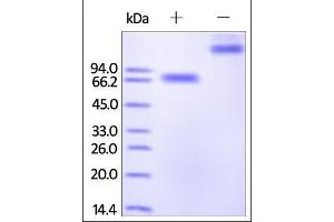 SDS-PAGE (SDS) image for Natural Killer Cell Receptor 2B4 (CD244) (AA 22-221) (Active) protein (Fc Tag) (ABIN2180732) (2B4 Protein (AA 22-221) (Fc Tag))