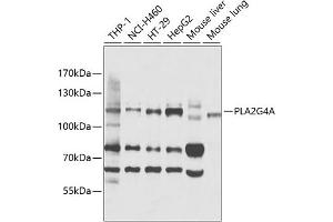 Western blot analysis of extracts of various cell lines, using PLG4A antibody (ABIN3020970, ABIN3020971, ABIN3020972 and ABIN6213833) at 1:1000 dilution.