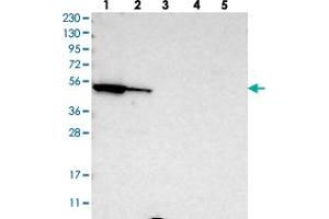 Western blot analysis of Lane 1: RT-4, Lane 2: U-251 MG, Lane 3: Human Plasma, Lane 4: Liver, Lane 5: Tonsil with FAR1 polyclonal antibody . (FAR1 antibody)