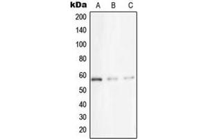 Western blot analysis of STK33 expression in A431 (A), Jurkat (B), HeLa (C) whole cell lysates.