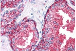 Human Prostate: Formalin-Fixed, Paraffin-Embedded (FFPE) (CD9 antibody)