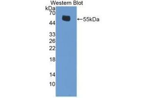 Detection of Recombinant ERb, Mouse using Polyclonal Antibody to Estrogen Receptor Beta (ERb) (ESR2 antibody  (AA 46-530))