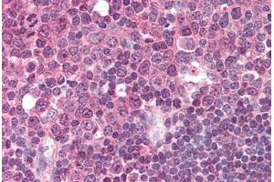 anti-Linker For Activation of T Cells Family, Member 2 (LAT2) (AA 196-212) antibody