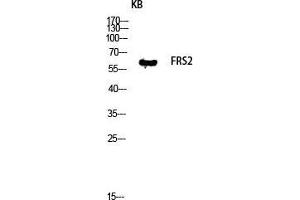 Western Blot (WB) analysis of KB lysis using FRS2 antibody.