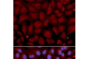 Immunofluorescence analysis of U2OS cells using BCHE Polyclonal Antibody (Butyrylcholinesterase antibody)
