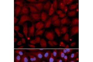 Immunofluorescence analysis of U2OS cells using BCHE Polyclonal Antibody