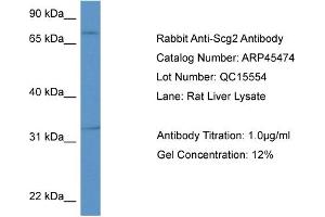Western Blotting (WB) image for anti-Secretogranin II (SCG2) (Middle Region) antibody (ABIN2782232) (SCG2 antibody  (Middle Region))