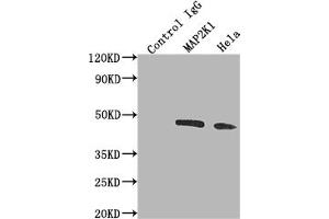 Immunoprecipitating MAP2K1 in Hela whole cell lysate Lane 1: Rabbit control IgG instead of ABIN7127612 in Hela whole cell lysate. (Recombinant MEK1 antibody)