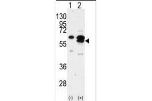 Western blot analysis of CK1G (arrow) using rabbit polyclonal CK1G Antibody (C-term) (R). (CAMK1G antibody  (C-Term))