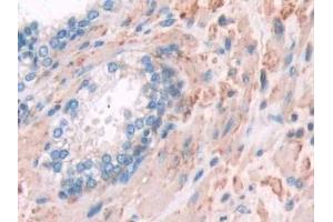 Immunohistochemistry (IHC) image for anti-Filamin A, alpha (FLNA) (AA 2-274) antibody (ABIN7440788)