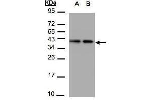 WB Image Sample(30 μg of whole cell lysate) A:A431, B:H1299 12% SDS PAGE antibody diluted at 1:1500 (TBCC antibody)