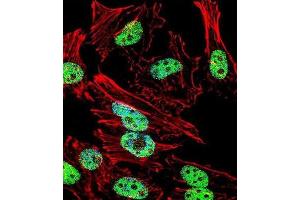 Immunofluorescence (IF) image for anti-T Antigen antibody (ABIN3001361) (T Antigen antibody)