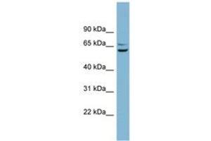 Image no. 1 for anti-Basic, Immunoglobulin-Like Variable Motif Containing (BIVM) (AA 431-480) antibody (ABIN6742149) (BIVM antibody  (AA 431-480))
