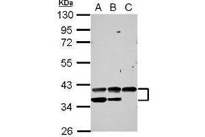 WB Image Sample (30 ug of whole cell lysate) A: 293T B: A431 C: HepG2 10% SDS PAGE antibody diluted at 1:1000