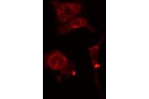 ABIN6277179 staining  Hela cells by IF/ICC. (DLGAP5 antibody  (N-Term))