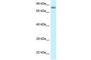 Image no. 1 for anti-Protein Phosphatase 6, Regulatory Subunit 3 (PPP6R3) (AA 627-676) antibody (ABIN6747777) (PPP6R3 antibody  (AA 627-676))