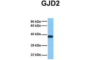 Host:  Rabbit  Target Name:  GJD2  Sample Tissue:  Human 293T  Antibody Dilution:  1. (GJD2 antibody  (Middle Region))