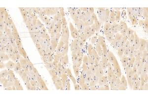 Detection of CD40L in Human Cardiac Muscle Tissue using Monoclonal Antibody to Cluster Of Differentiation 40 Ligand (CD40L) (CD40 Ligand antibody  (AA 180-261))