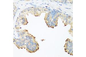 Immunohistochemistry of paraffin-embedded human prostate using PLEK antibody (ABIN6290796) at dilution of 1:200 (40x lens).