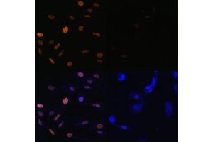 Immunofluorescence analysis of NIH/3T3 cells using Acetyl-Histone H3-K23 (ABIN7267669) at dilution of 1:100. (Histone 3 antibody  (H3K23))