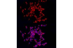 Immunofluorescence analysis of SH-SY5Y cells using CART Rabbit pAb (ABIN6131305, ABIN6137949, ABIN6137950 and ABIN6221042) at dilution of 1:250 (40x lens). (CARTPT antibody  (AA 28-116))