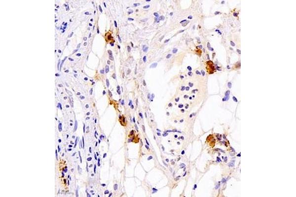 Calcitonin antibody