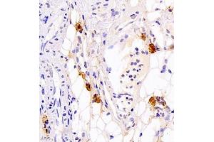 Immunohistochemistry of paraffin embedded rat thyroid gland using Calcitonin (ABIN7073271) at dilution of 1:700 (400x lens) (Calcitonin antibody)