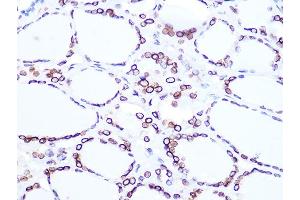 Immunohistochemistry (IHC) image for anti-Lamin B2 (LMNB2) antibody (ABIN1679310)