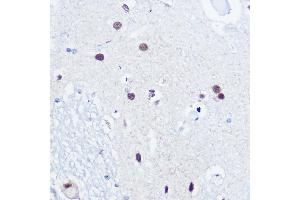 Immunohistochemistry of paraffin-embedded human brain using 53BP1 Rabbit pAb (ABIN6128833, ABIN6149414, ABIN6149415 and ABIN6221431) at dilution of 1:100 (40x lens). (TP53BP1 antibody  (AA 1763-1977))