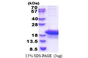ARPP19 Protein (AA 1-112) (His tag)