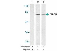 Western blot analysis of exreacts from HT-29 and K-562 cells untreated or treated with anisomycin (1mM, 30 min) using PRKCQ polyclonal antibody . (PKC theta antibody)