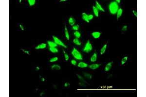 Immunofluorescence of purified MaxPab antibody to HMOX1 on HeLa cell. (HMOX1 antibody  (AA 1-288))