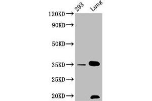 Western Blot Positive WB detected in: 293 whole cell lysate, Mouse lung tissue All lanes: CNN1 antibody at 1. (Recombinant CNN1 antibody)