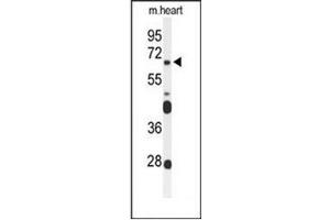 Western blot analysis of FZD4 Antibody (C-term) in mouse heart tissue lysates (35ug/lane). (FZD4 antibody  (C-Term))