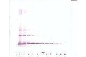Image no. 1 for anti-Chemokine (C-C Motif) Ligand 2 (CCL2) antibody (ABIN465001) (CCL2 antibody)